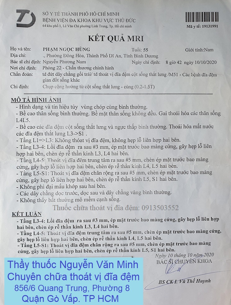 Thoát vị đĩa đệm L4 L5, L5 S1